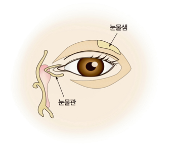 안구 건조증